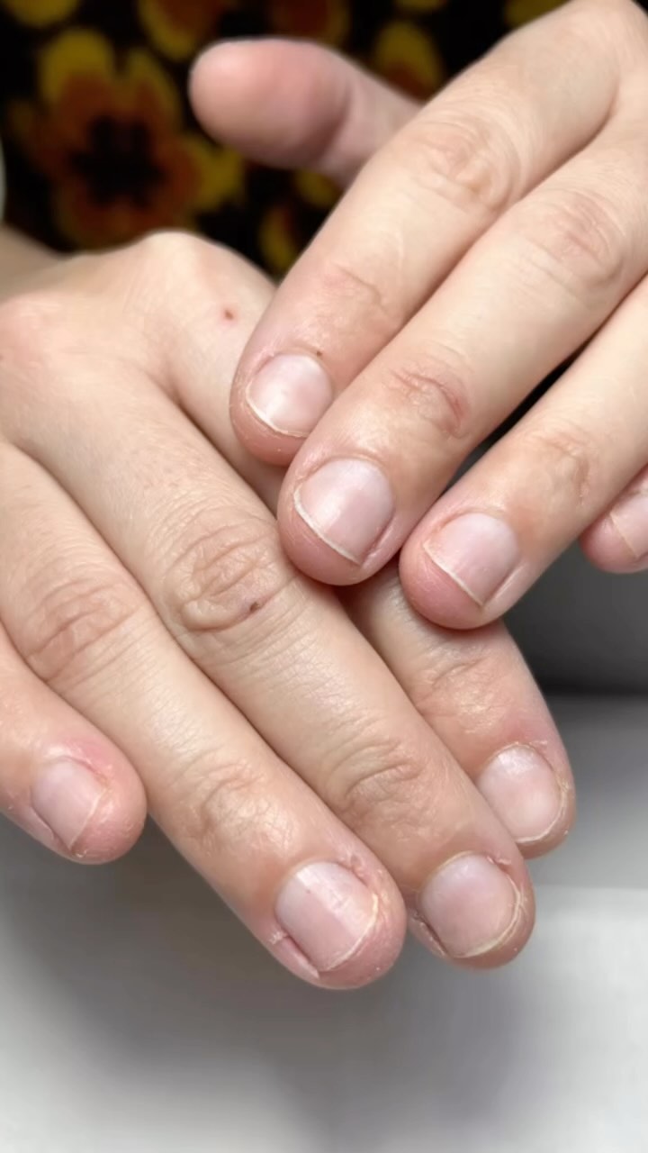 Uñas naturales antes del tratamiento, cutículas sin trabajar